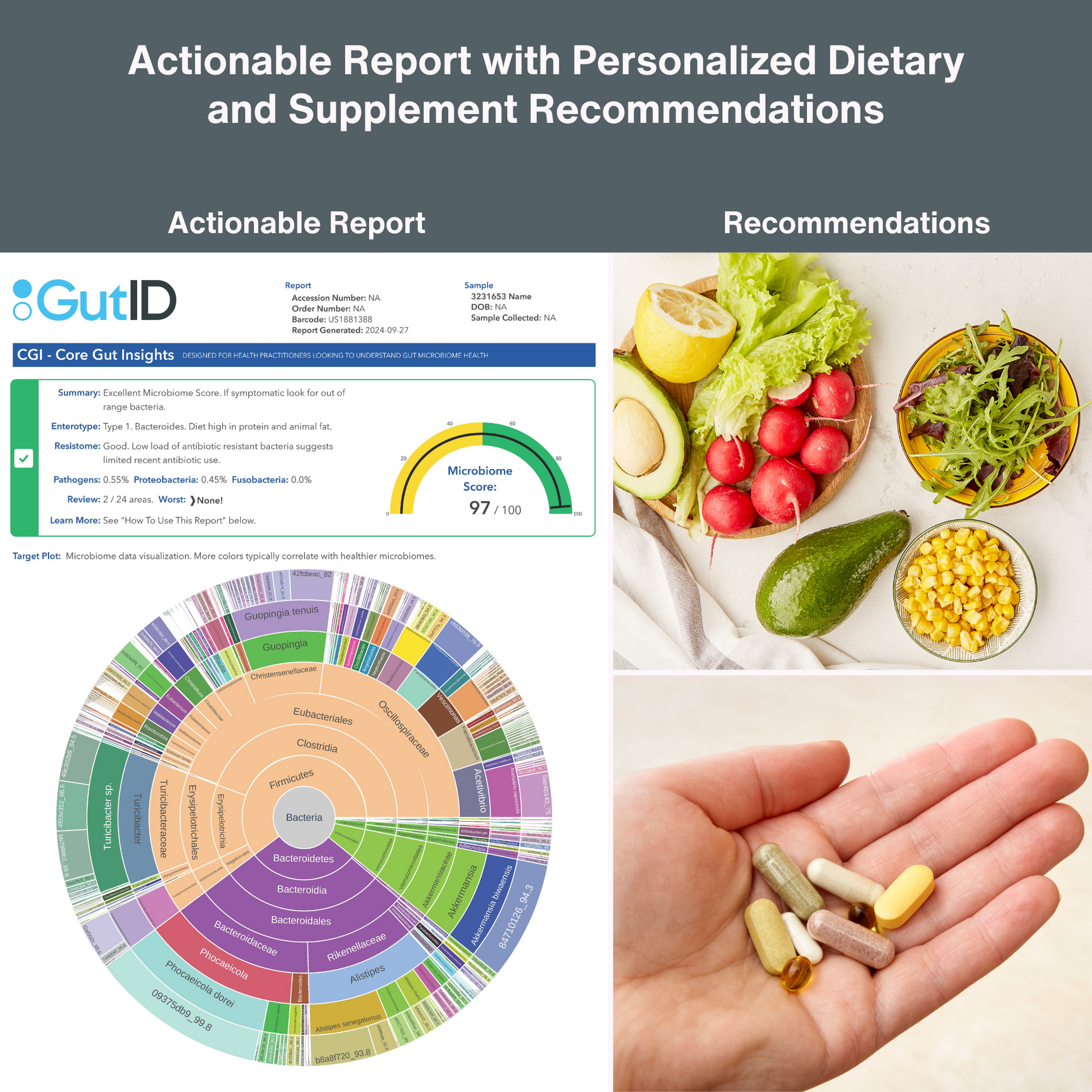 GutID Microbiome Test, Actionable Gut Microbiome Test