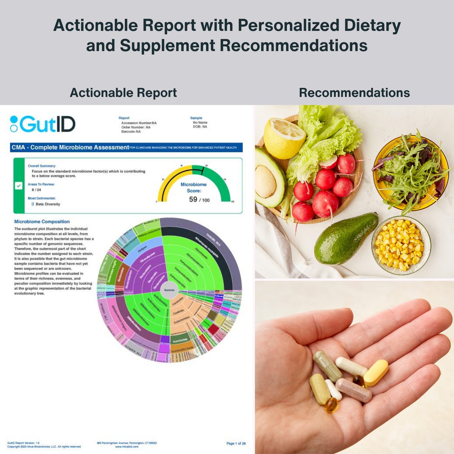 GutID CMA - Complete Microbiome Assessment US